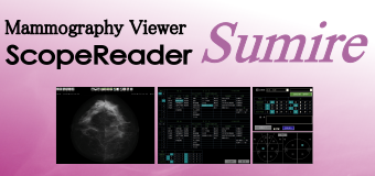 Mammography Viewer ScopeReader Sumire