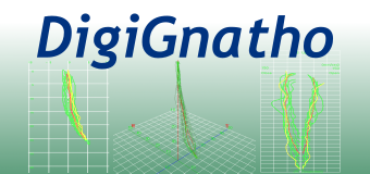 顎運動解析 DigiGnatho